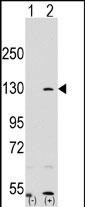 PARP1 Antibody in Western Blot (WB)