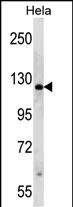 PARP1 Antibody in Western Blot (WB)