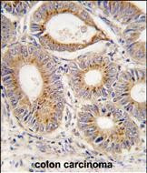 FGF1 Antibody in Immunohistochemistry (Paraffin) (IHC (P))