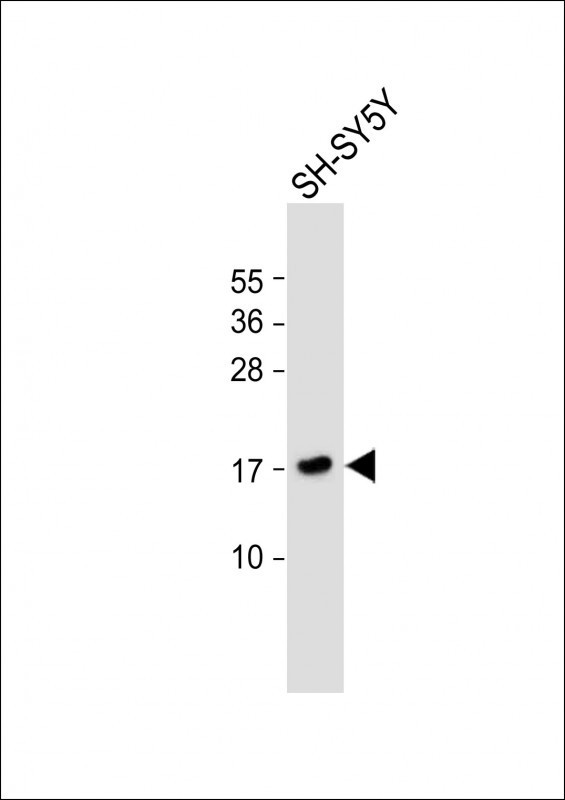 FGF1 Antibody in Western Blot (WB)