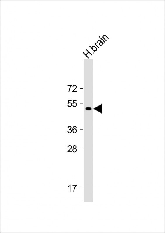 Parkin Antibody in Western Blot (WB)