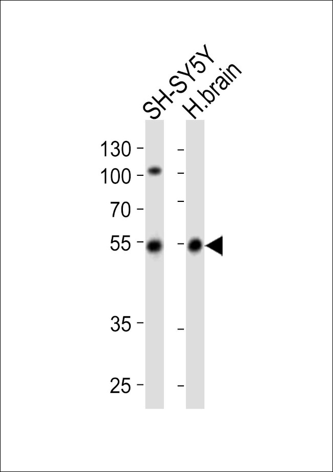 Parkin Antibody in Western Blot (WB)