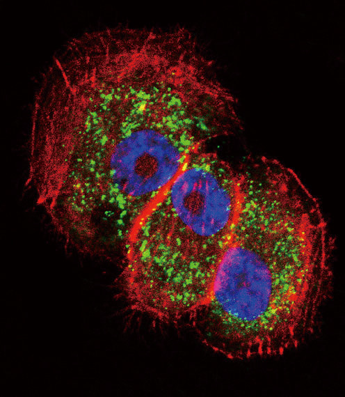 Parkin Antibody in Immunocytochemistry (ICC/IF)