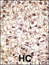 Parkin Antibody in Immunohistochemistry (Paraffin) (IHC (P))