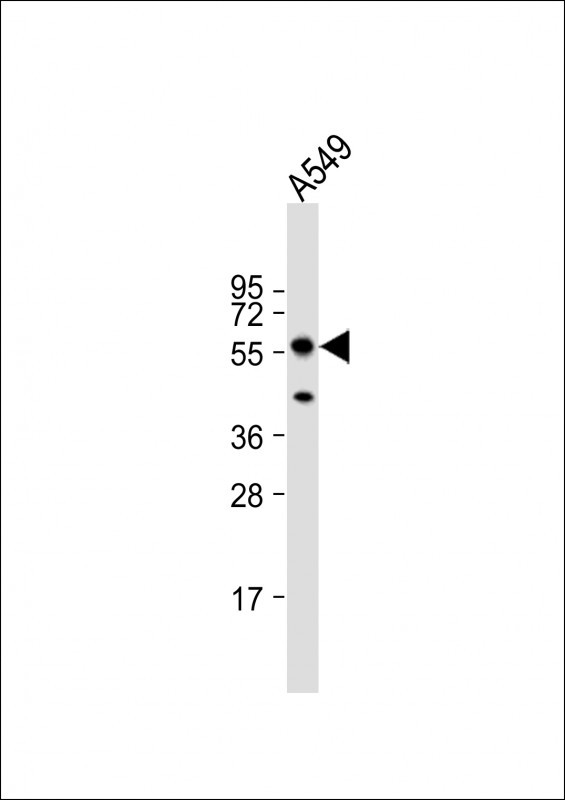 PINK1 Antibody in Western Blot (WB)