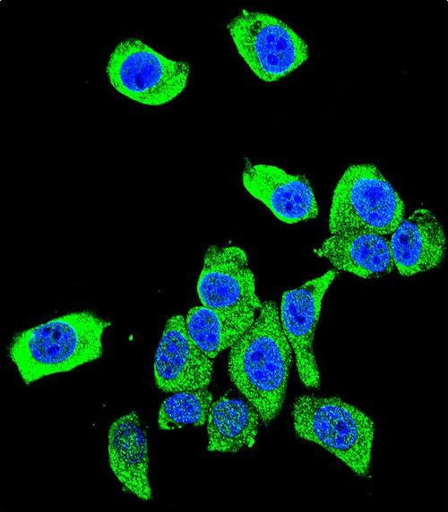 DJ-1 Antibody in Immunocytochemistry (ICC/IF)