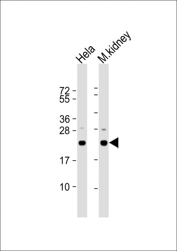 DJ-1 Antibody in Western Blot (WB)