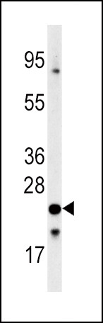 FXN Antibody in Western Blot (WB)