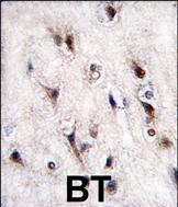 Nurr1 Antibody in Immunohistochemistry (Paraffin) (IHC (P))