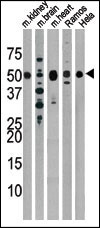 Parkin Antibody in Western Blot (WB)