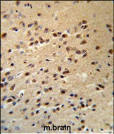 Alsin Antibody in Immunohistochemistry (Paraffin) (IHC (P))