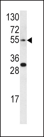 Endothelin A Receptor Antibody in Western Blot (WB)