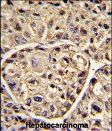 ELOVL6 Antibody in Immunohistochemistry (Paraffin) (IHC (P))