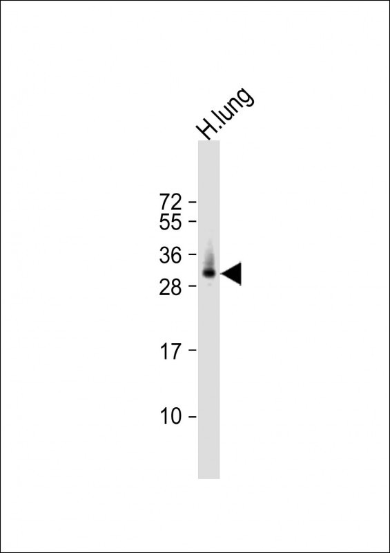 ELOVL6 Antibody in Western Blot (WB)