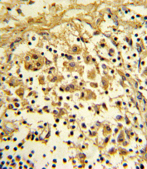 ENO1 Antibody in Immunohistochemistry (Paraffin) (IHC (P))