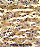 FABP3 Antibody in Immunohistochemistry (Paraffin) (IHC (P))