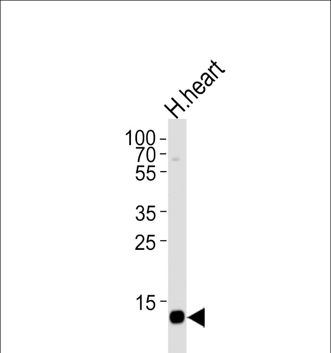 FABP3 Antibody in Western Blot (WB)