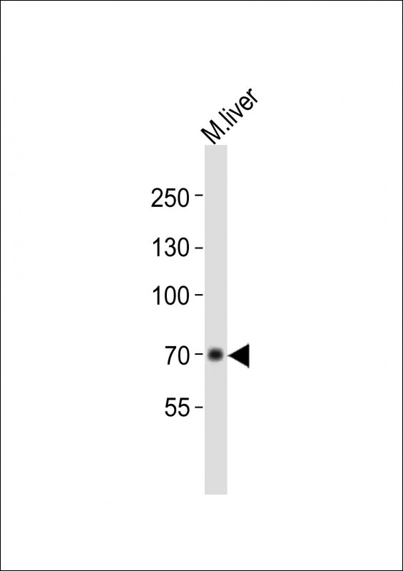 Albumin Antibody in Western Blot (WB)