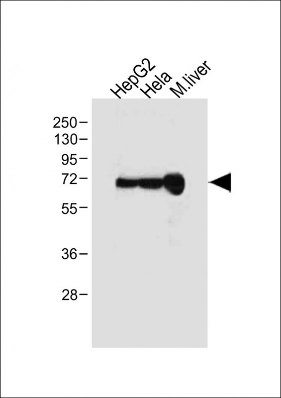 Albumin Antibody in Western Blot (WB)