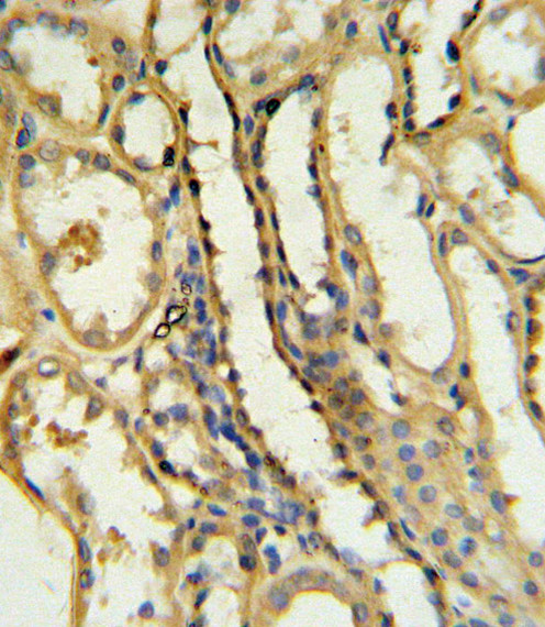 CD154 (CD40 Ligand) Antibody in Immunohistochemistry (Paraffin) (IHC (P))