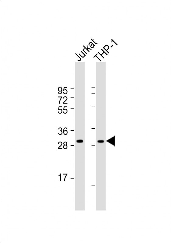 CD154 (CD40 Ligand) Antibody in Western Blot (WB)