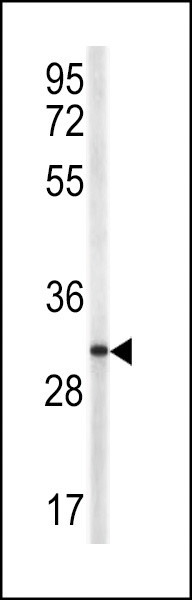 CD154 (CD40 Ligand) Antibody in Western Blot (WB)
