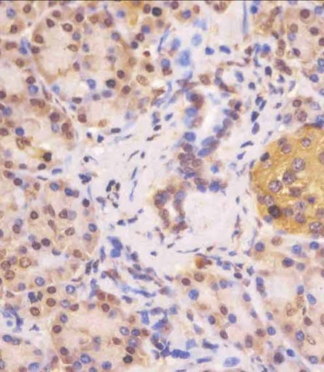 VHL Antibody in Immunohistochemistry (Paraffin) (IHC (P))