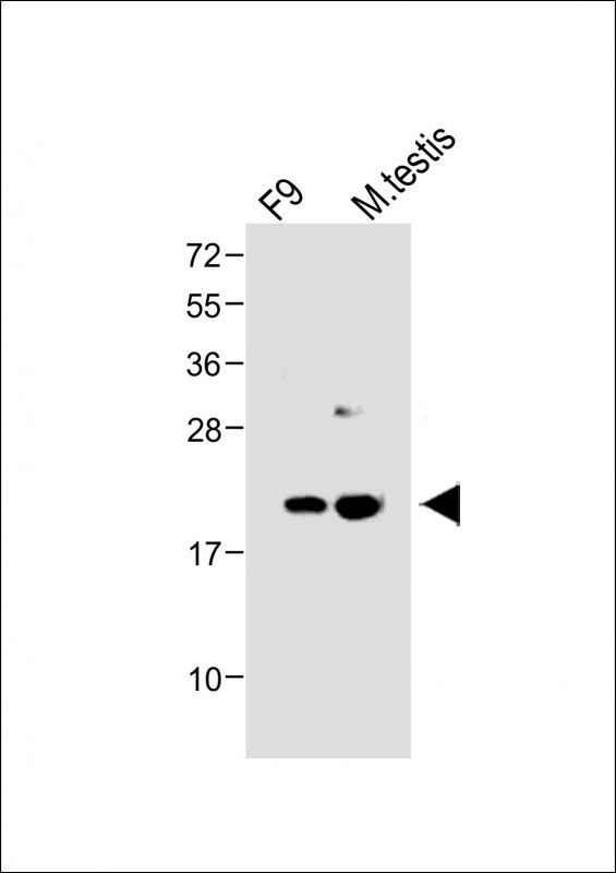 VHL Antibody in Western Blot (WB)