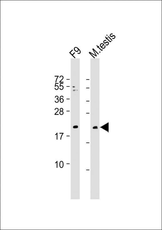 VHL Antibody in Western Blot (WB)