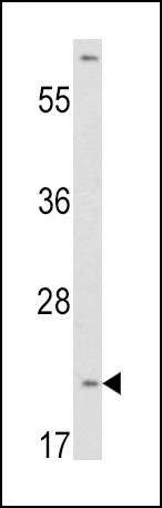 VHL Antibody in Western Blot (WB)