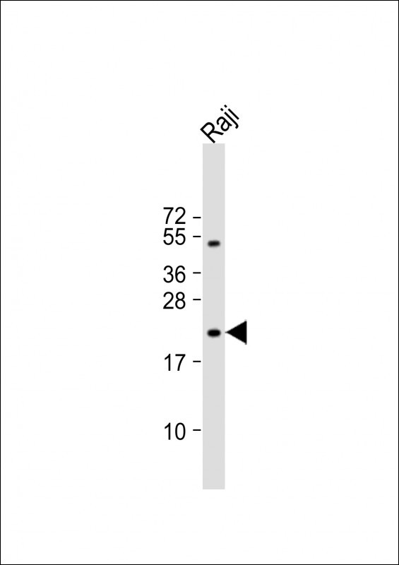 VHL Antibody in Western Blot (WB)