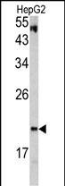 VHL Antibody in Western Blot (WB)