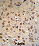 AMER1 Antibody in Immunohistochemistry (Paraffin) (IHC (P))