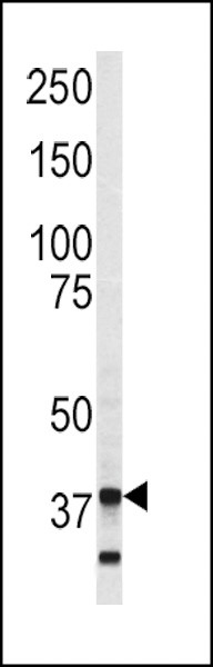 Annexin V Antibody in Western Blot (WB)