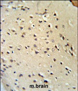 Lamin B1 Antibody in Immunohistochemistry (Paraffin) (IHC (P))