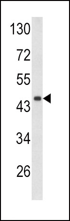 Decorin Antibody in Western Blot (WB)