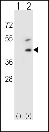 Decorin Antibody in Western Blot (WB)