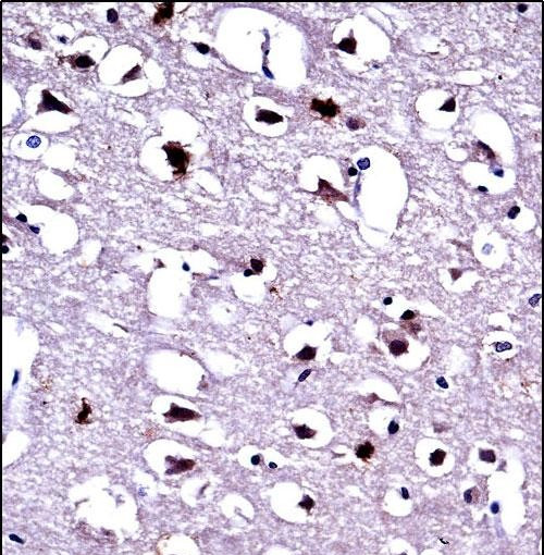 EEF1A1 Antibody in Immunohistochemistry (Paraffin) (IHC (P))