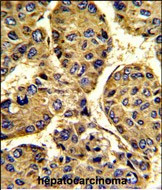 Asporin Antibody in Immunohistochemistry (Paraffin) (IHC (P))