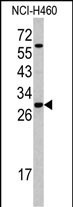 SRSF5 Antibody in Western Blot (WB)