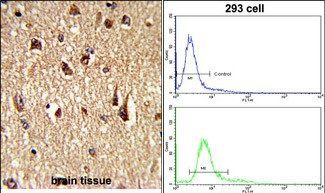 FOXO1 Antibody in Immunohistochemistry (Paraffin) (IHC (P))