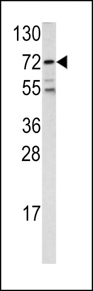 FOXO1 Antibody in Western Blot (WB)