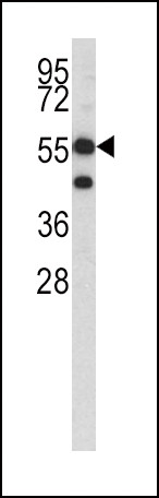 HMGCS1 Antibody in Western Blot (WB)