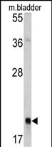 RAB13 Antibody in Western Blot (WB)