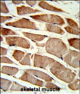 TAGLN Antibody in Immunohistochemistry (Paraffin) (IHC (P))