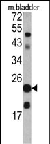 TAGLN Antibody in Western Blot (WB)