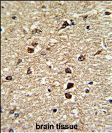 CRM1 Antibody in Immunohistochemistry (Paraffin) (IHC (P))