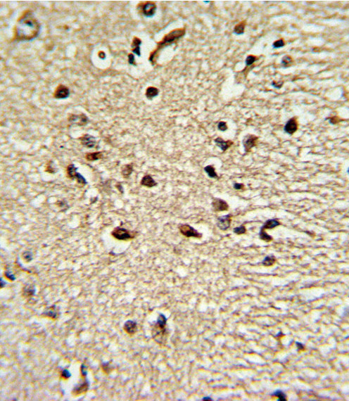 PAX4 Antibody in Immunohistochemistry (Paraffin) (IHC (P))