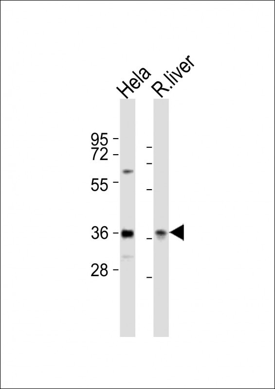 PAX4 Antibody in Western Blot (WB)