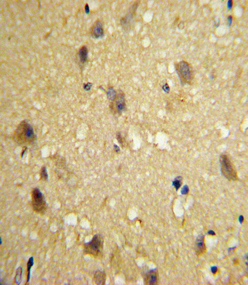 MCP-1 Antibody in Immunohistochemistry (Paraffin) (IHC (P))